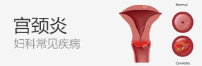 宫颈炎
