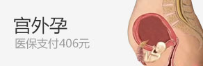 宫外孕